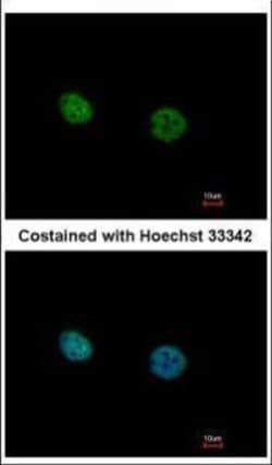 Invitrogen NR2C2 Polyclonal Antibody 100 &mu;L; Unconjugated:Antibodies,
