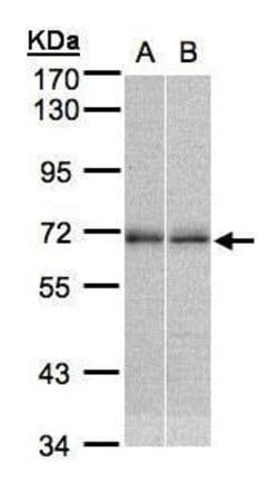 Invitrogen NR2C2 Polyclonal Antibody 100 &mu;L; Unconjugated:Antibodies,