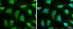 OGDH Polyclonal Antibody:Antibodies, Polyclonal