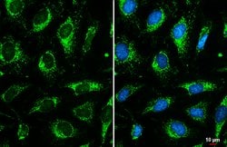 OGDH Polyclonal Antibody:Antibodies, Polyclonal