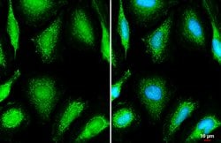 OGDH Polyclonal Antibody:Antibodies, Polyclonal