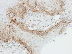 OGDH Polyclonal Antibody:Antibodies, Polyclonal