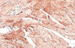 OGDH Polyclonal Antibody:Antibodies, Polyclonal
