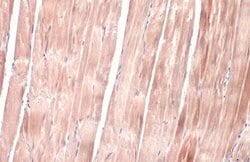 OGDH Polyclonal Antibody:Antibodies, Polyclonal