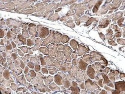 OGDH Polyclonal Antibody:Antibodies, Polyclonal