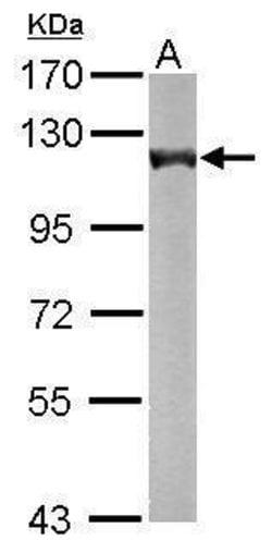 OGDH Polyclonal Antibody:Antibodies, Polyclonal