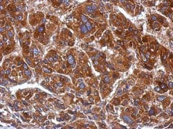 Invitrogen POLRMT Polyclonal Antibody 100 &mu;L; Unconjugated:Antibodies,