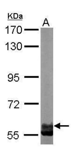 Invitrogen TCP-1 zeta Polyclonal Antibody 100 &mu;L; Unconjugated:Antibodies,