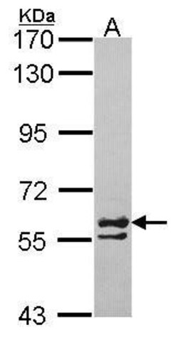 Invitrogen TCP-1 zeta Polyclonal Antibody 100 &mu;L | Buy Online | Invitrogen&trade; | Fisher Scientific