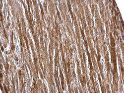 Invitrogen ETFA Polyclonal Antibody 100 &mu;L; Unconjugated:Antibodies,