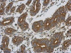 Invitrogen ETFA Polyclonal Antibody 100 &mu;L; Unconjugated:Antibodies,