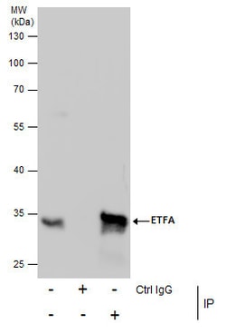 Invitrogen ETFA Polyclonal Antibody 100 &mu;L; Unconjugated:Antibodies,