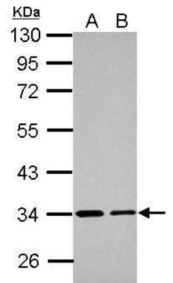 Invitrogen ETFA Polyclonal Antibody 100 &mu;L; Unconjugated:Antibodies,