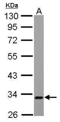 Invitrogen ETFA Polyclonal Antibody 100 &mu;L; Unconjugated:Antibodies,