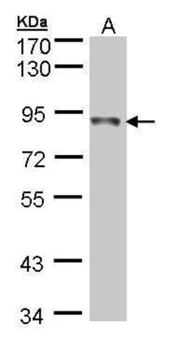 NDUFS1 Polyclonal Antibody, Invitrogen 100 &mu;L; Unconjugated:Antibodies,