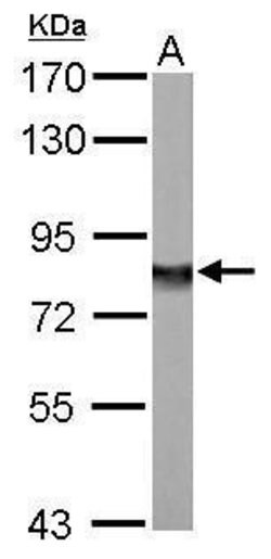NDUFS1 Polyclonal Antibody, Invitrogen 100 &mu;L; Unconjugated:Antibodies,