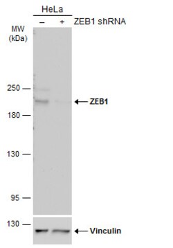 Invitrogen ZEB1 Polyclonal Antibody 100 &mu;L; Unconjugated:Antibodies,
