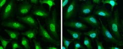 Invitrogen PP1 beta Polyclonal Antibody 100 &mu;L; Unconjugated:Antibodies,