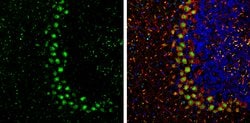 Invitrogen PP1 beta Polyclonal Antibody 100 &mu;L; Unconjugated:Antibodies,