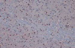 Invitrogen PP1 beta Polyclonal Antibody 100 &mu;L; Unconjugated:Antibodies,