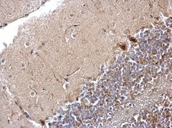 Invitrogen PP1 beta Polyclonal Antibody 100 &mu;L; Unconjugated:Antibodies,
