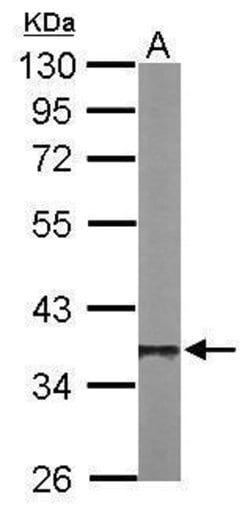 Invitrogen PP1 beta Polyclonal Antibody 100 &mu;L; Unconjugated:Antibodies,