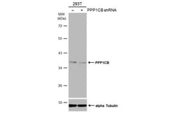 Invitrogen PP1 beta Polyclonal Antibody 100 &mu;L | Buy Online | Invitrogen&trade; | Fisher Scientific