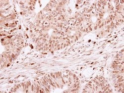 Invitrogen SKAP55 Polyclonal Antibody 100 &mu;L; Unconjugated:Antibodies,