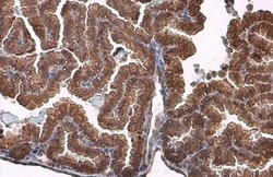 Invitrogen ACVR2B Polyclonal Antibody 100 &mu;L; Unconjugated:Antibodies,