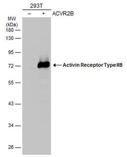 Invitrogen ACVR2B Polyclonal Antibody 100 &mu;L; Unconjugated:Antibodies,