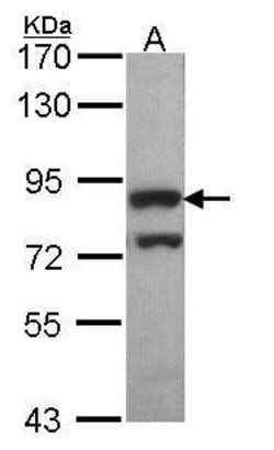 Invitrogen PWP2 Polyclonal Antibody 100 &mu;L | Buy Online | Invitrogen&trade; | Fisher Scientific