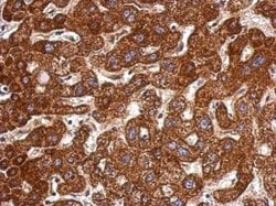 Invitrogen LSS Polyclonal Antibody 100 &mu;L; Unconjugated:Antibodies,