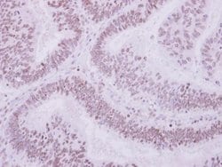 Invitrogen ULK4 Polyclonal Antibody 100 &mu;L | Buy Online | Invitrogen&trade; | Fisher Scientific