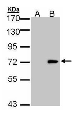 Invitrogen ULK4 Polyclonal Antibody 100 &mu;L | Buy Online | Invitrogen&trade; | Fisher Scientific
