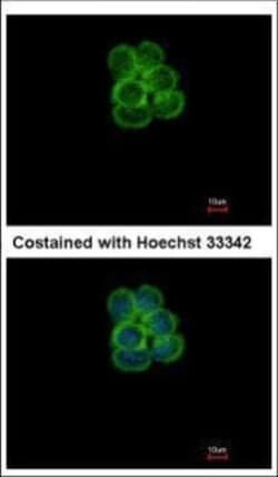 Invitrogen SGLT1 Polyclonal Antibody 100 &mu;L | Buy Online | Invitrogen&trade; | Fisher Scientific