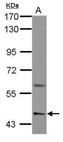 Invitrogen ASIC1 Polyclonal Antibody 100 &mu;L; Unconjugated:Antibodies,