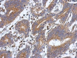 ATXN10 Polyclonal Antibody:Antibodies, Polyclonal