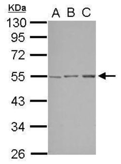 Invitrogen STK38L Polyclonal Antibody 100 &mu;L; Unconjugated:Antibodies,