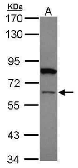ZNF449 Polyclonal Antibody:Antibodies, Polyclonal