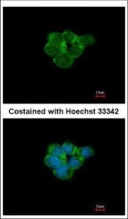 Invitrogen CHRNA3 Polyclonal Antibody 100 &mu;L | Buy Online | Invitrogen&trade; | Fisher Scientific
