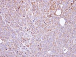 Invitrogen STS Polyclonal Antibody 100 &mu;L; Unconjugated:Antibodies,