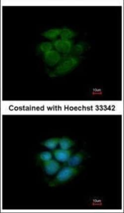 Invitrogen JNK2 Polyclonal Antibody 100 &mu;L; Unconjugated:Antibodies,