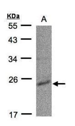 Invitrogen CMPK1 Polyclonal Antibody 100 &mu;L | Buy Online | Invitrogen&trade; | Fisher Scientific