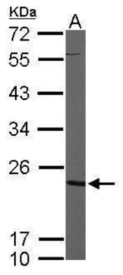 Invitrogen CMPK1 Polyclonal Antibody 100 &mu;L | Buy Online | Invitrogen&trade; | Fisher Scientific