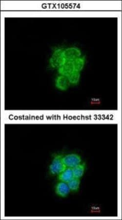 Invitrogen MIPEP Polyclonal Antibody 100 &mu;L; Unconjugated:Antibodies,