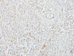 Invitrogen MIPEP Polyclonal Antibody 100 &mu;L; Unconjugated:Antibodies,