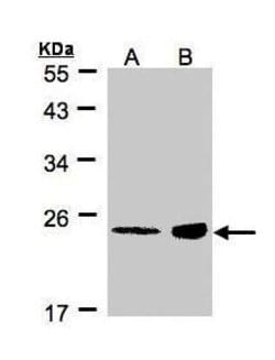 Invitrogen RRAS Polyclonal Antibody 100 &mu;L; Unconjugated:Antibodies,