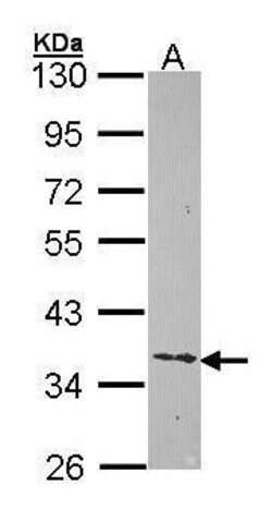 Invitrogen Ephrin B2 Polyclonal Antibody 100 &mu;L | Buy Online | Invitrogen&trade; | Fisher Scientific