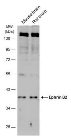 Invitrogen Ephrin B2 Polyclonal Antibody 100 &mu;L | Buy Online | Invitrogen&trade; | Fisher Scientific