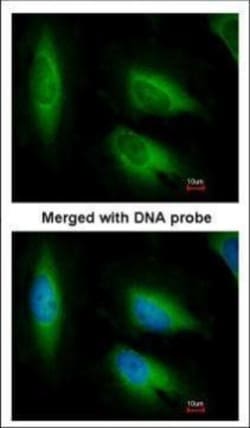 Invitrogen EEF1E1 Polyclonal Antibody 100 &mu;L; Unconjugated:Antibodies,